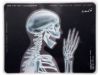 Коврик для мыши с рентгеновским снимком скелета
